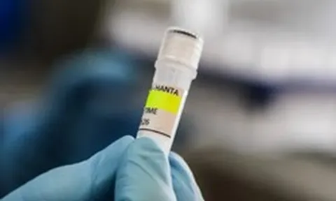 Anh, Tây Ban Nha phát hiện ca nhiễm hantavirus mới