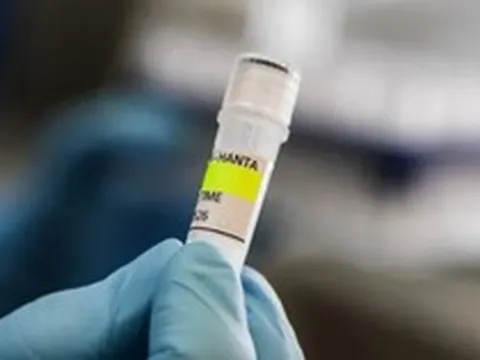 Anh, Tây Ban Nha phát hiện ca nhiễm hantavirus mới